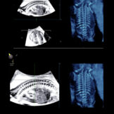 Apparato scheletrico